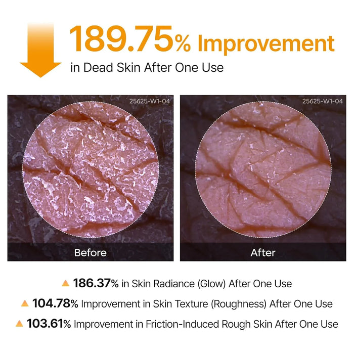 [Dr.Melaxin] Peel Shot Exfoliating Kojic Acid Turmeric Spray 200ml - Ballagrio