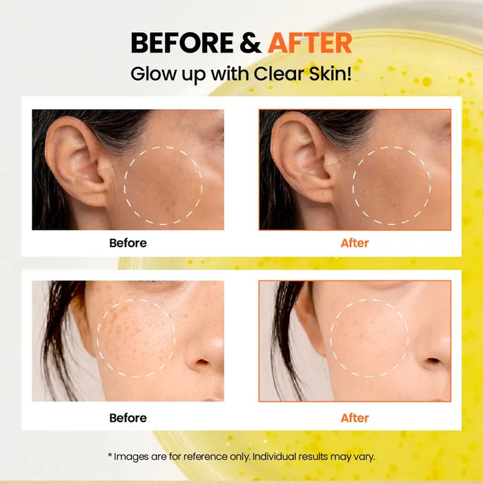 K-Secret Seoul 1988 Glow Serum Niacinamide15%+Yuja 30Ml