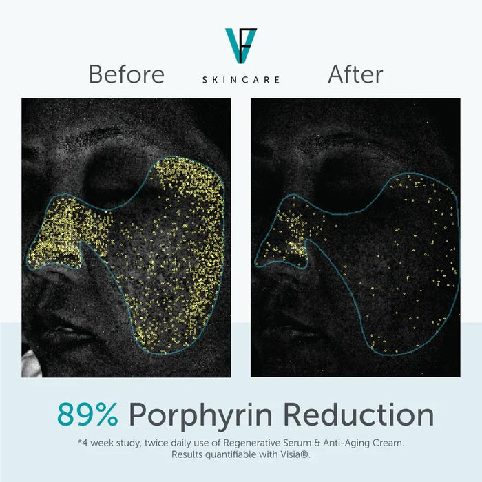 Regenerative Serum