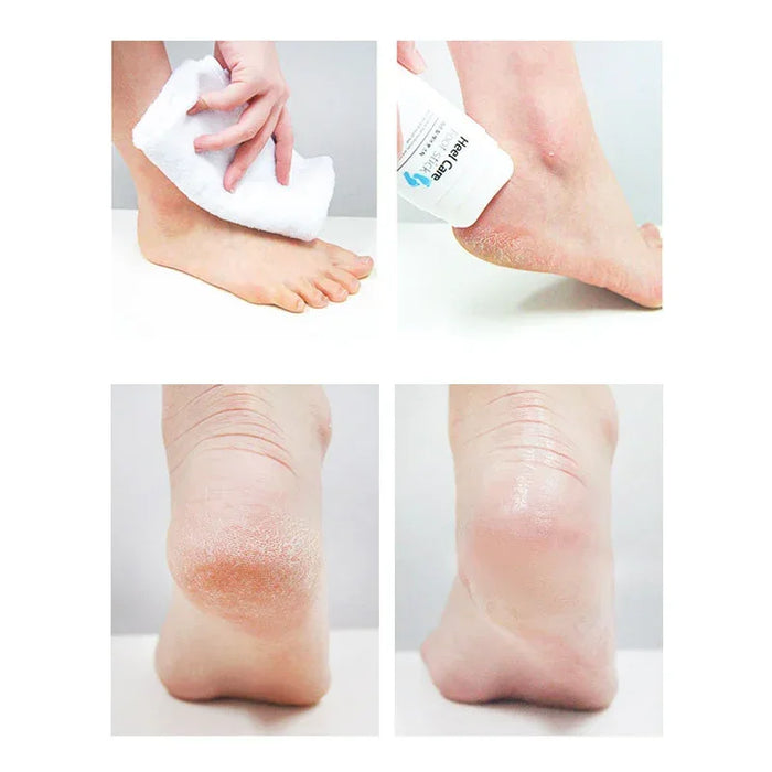 [RiRe] Heel Care Foot Stick 22g - Ballagrio